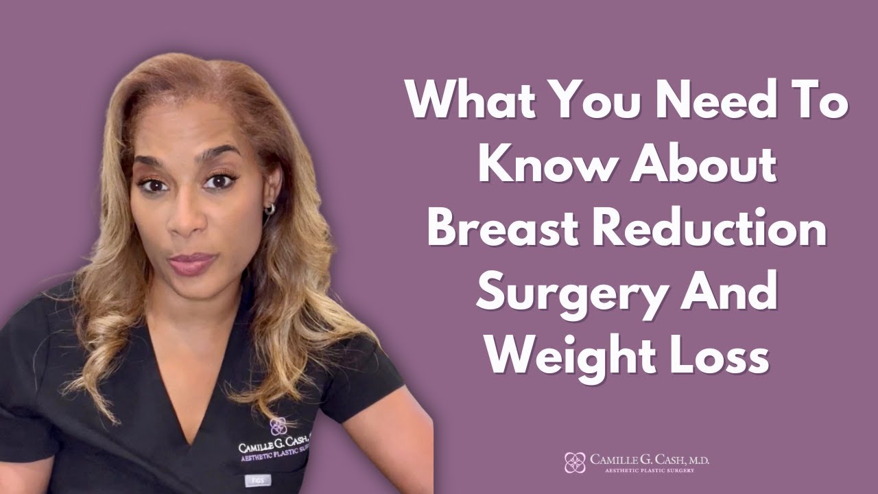 Do You Need To Be at Your Target Weight Before a Breast Reduction? I Dr. Camille Cash in Houston
