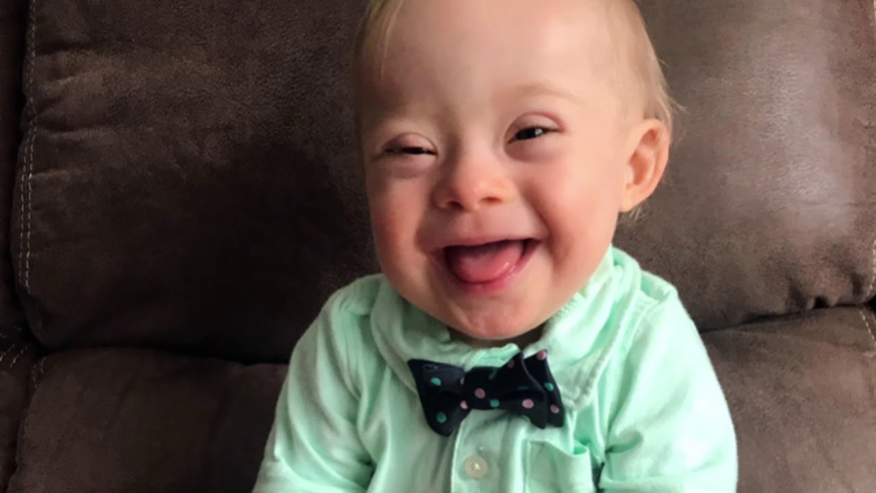 The OFFICIAL Down syndrome TED talk