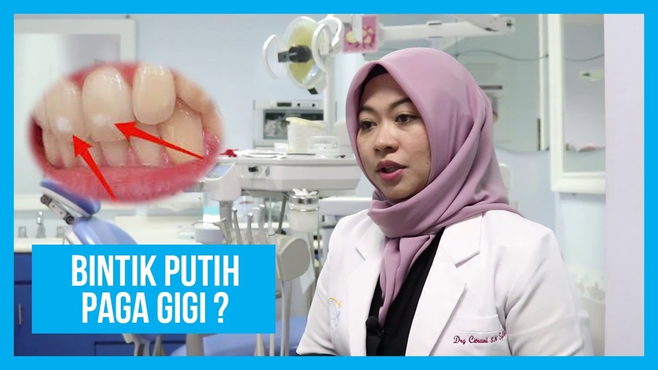 Bercak Putih Pada Gigi? Bisa Jadi Tanda Awal Gigi Berlubang Pada Anak Dan Balita