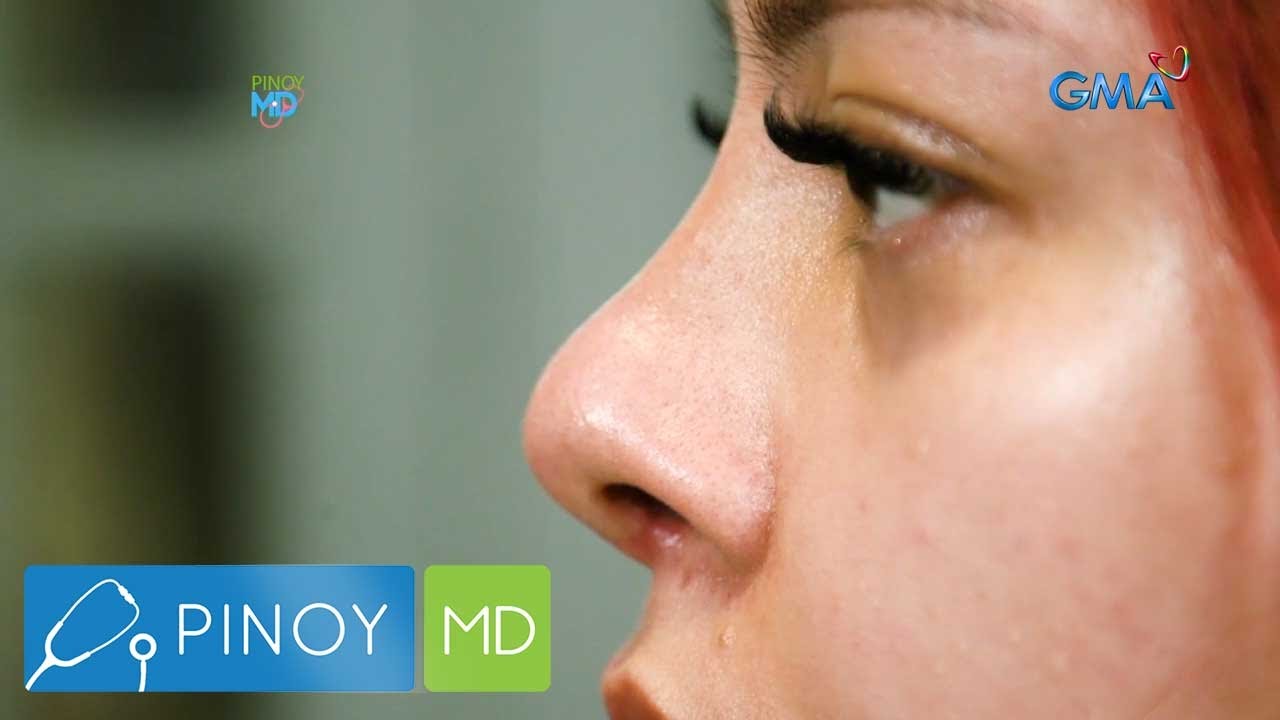Sasali ka ba sa paluwagan kung ang sahod, pagpapatangos ng ilong? | Pinoy MD