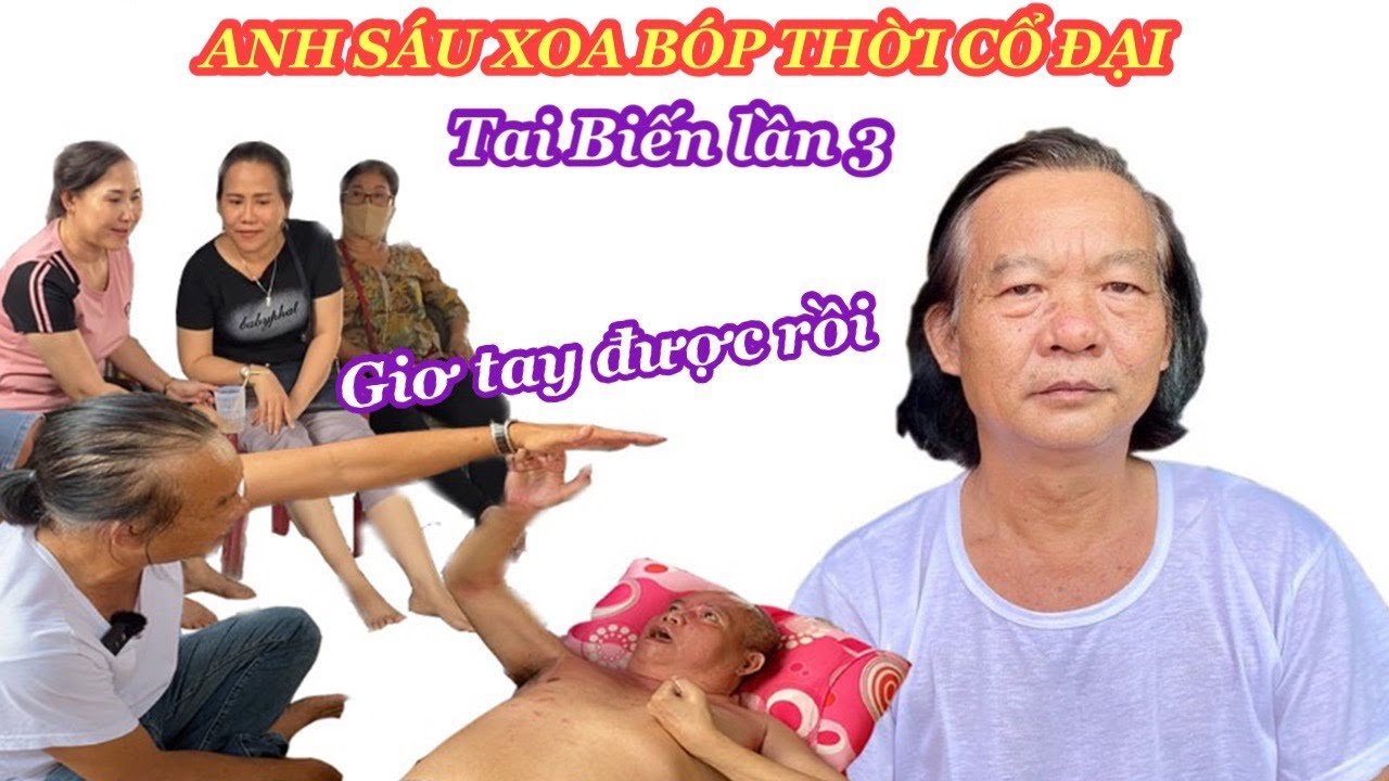 Bệnh Tai Biến Lần 3 được ANH SÁU điều trị lần đầu mở tay ra được
