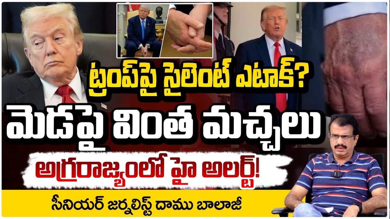 ట్రంప్ కు తీవ్ర అనారోగ్యం! | Donald Trump health condition Latest Update | Daamu Balaji | Red TV