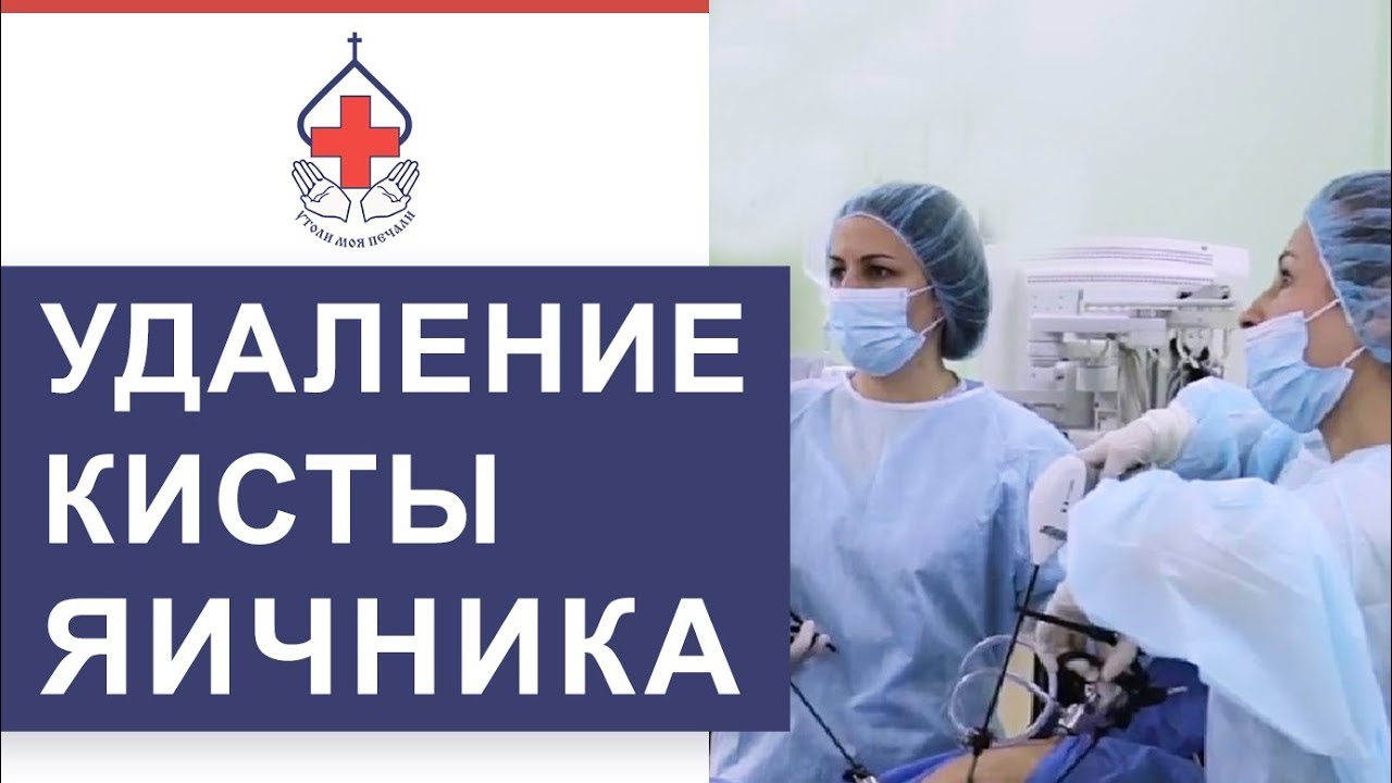 🔬 Как делается лапароскопия кисты яичника, каковы сроки реабилитации. Лапароскопия кисты яичника.12+