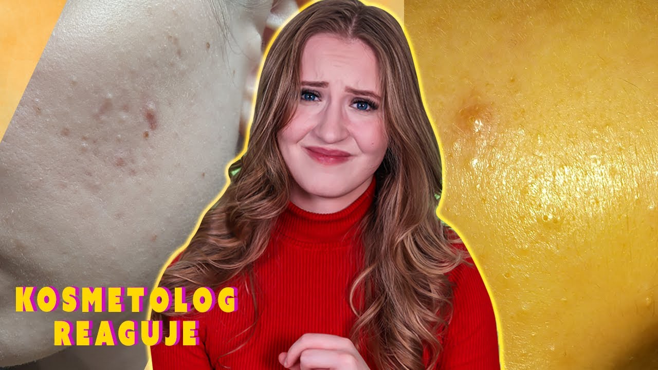 Kosmetolog reaguje na pielęgnacje widzów #6 oleje do cery tłustej?