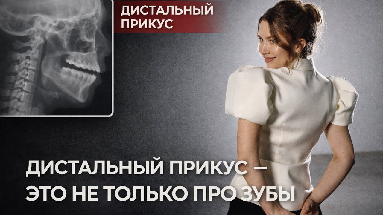 5 признаков дистального прикуса, которые вы видите в зеркале.