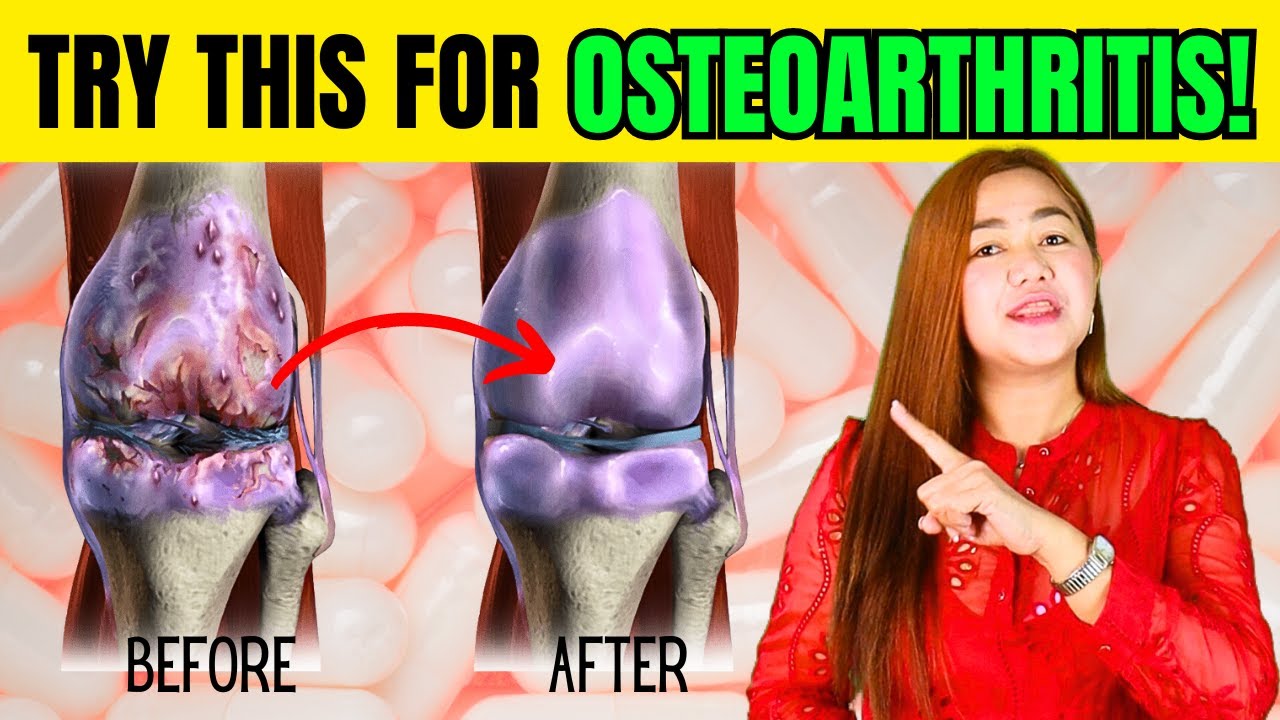 SURPRISING Reasons Why You NEED Glucosamine for Osteoarthritis!| Doc Cherry