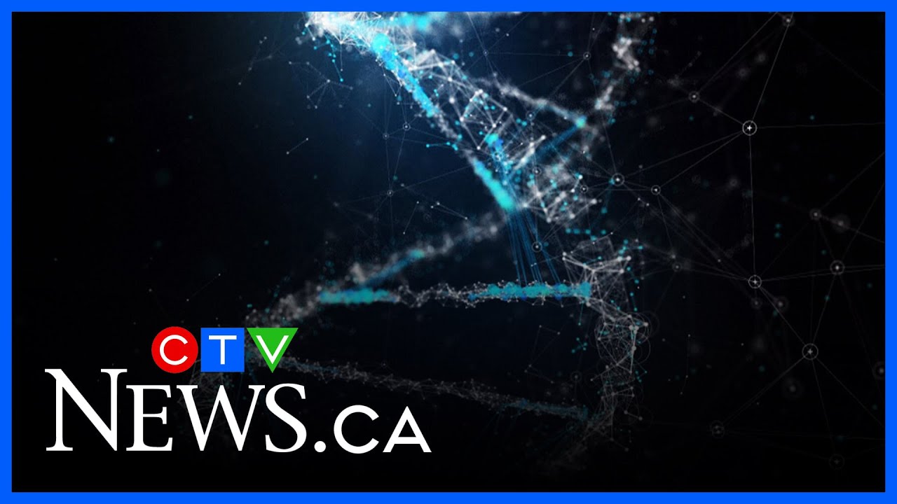 Promising results of new one-time treatment for Huntington’s Disease