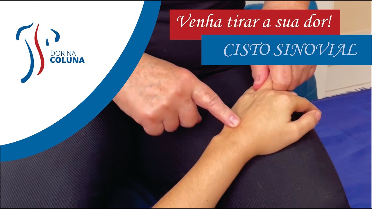 CISTO SINOVIAL