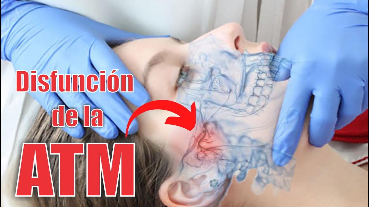 🥵 SINTOMAS de Disfunsión de la Articulación TemporoMandibular (ATM) 👄 Dr SANTIAGO BURGA 3D DDD