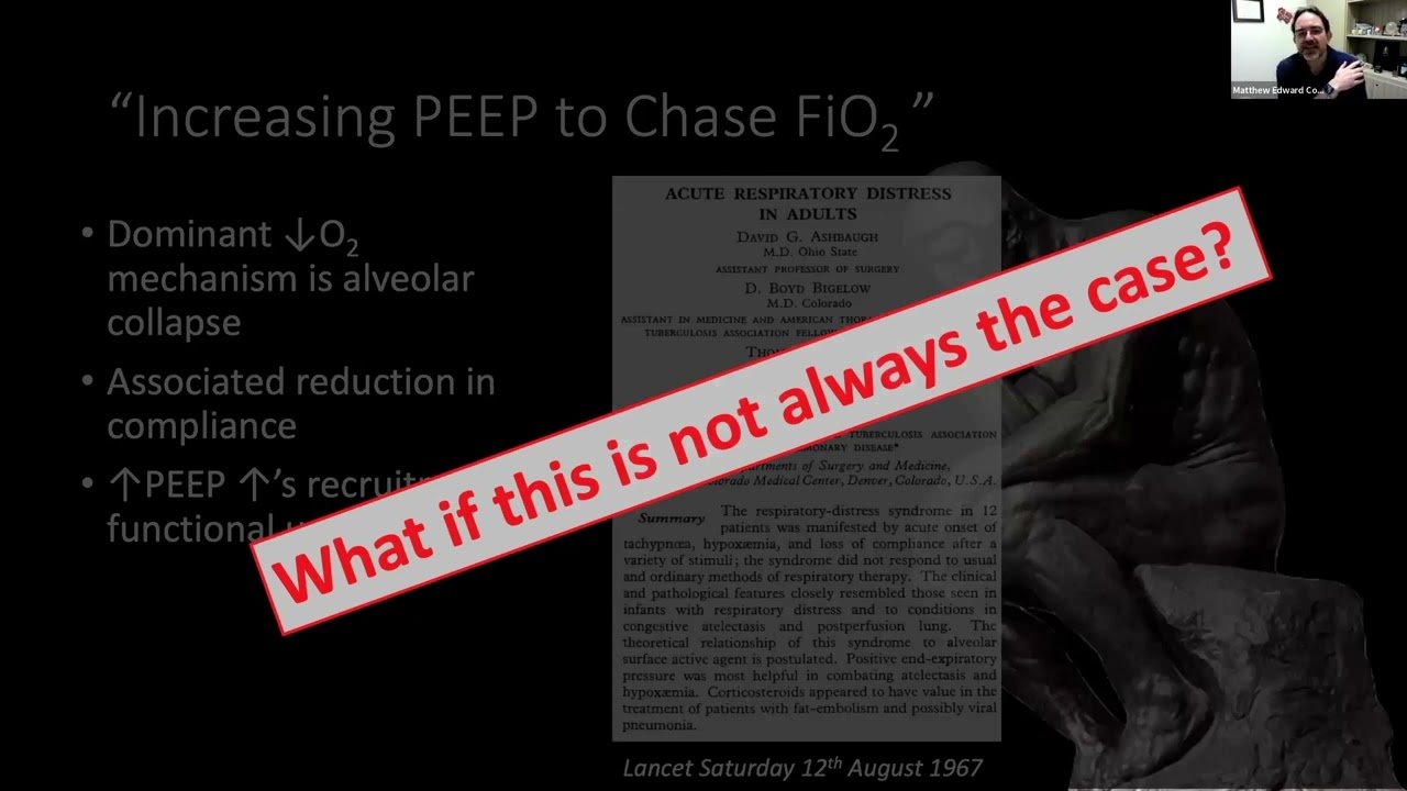 VM 302   Cove's  Are We Ready to Think Differently About Setting PEEP