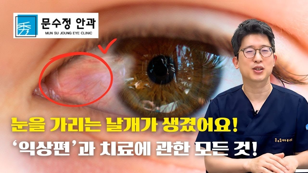 눈에서 날개가 자라나는 '익상편' 혹시 아시나요?