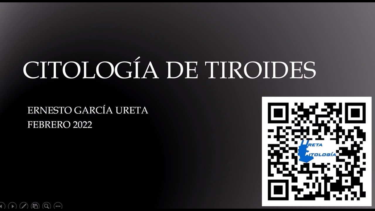 Citología de tiroides