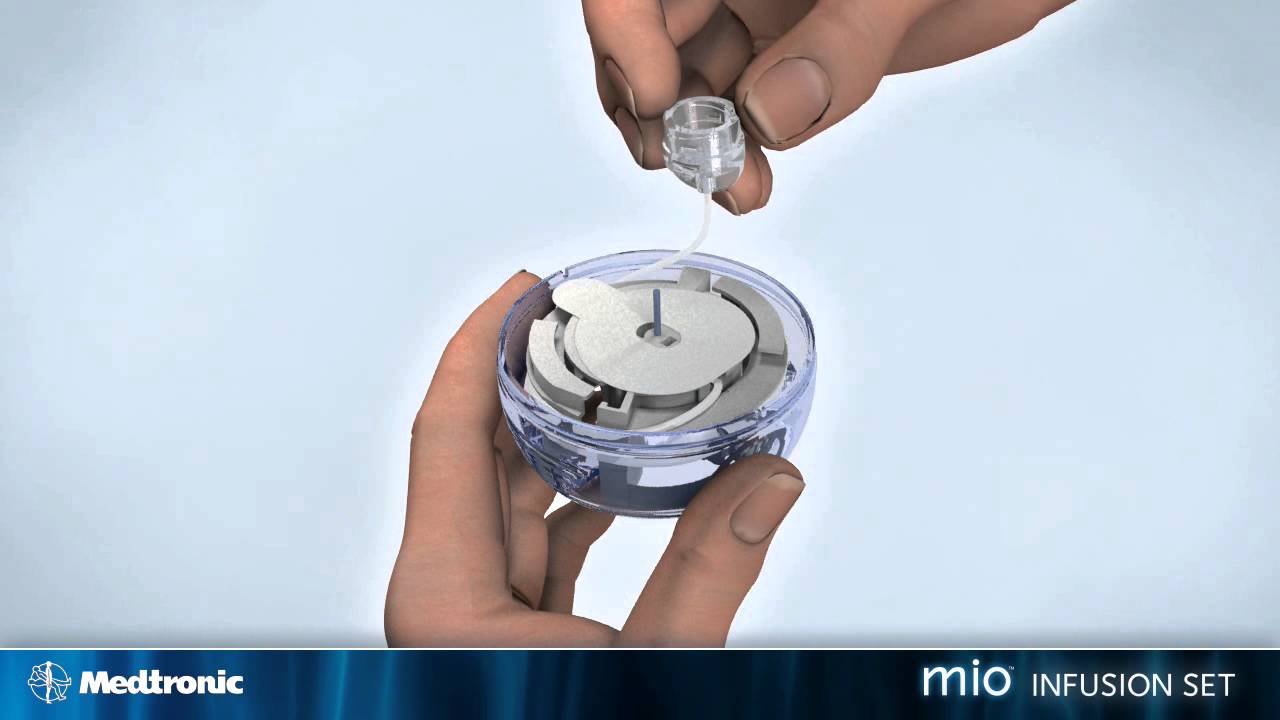 Mio™ infusion set