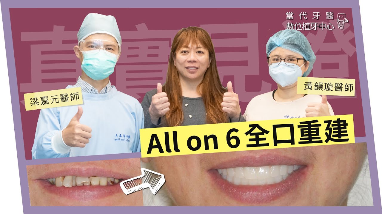 【All-on-6全口重建】一日全口重建，重拾美味心感動