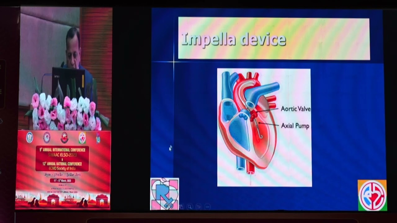 PRO CON DEBATE  ECMO IMPELLA