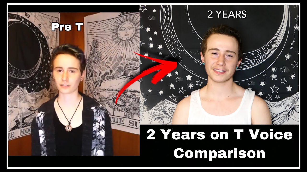 Two Years on Testosterone Voice Comparison // Transgender FTM HRT