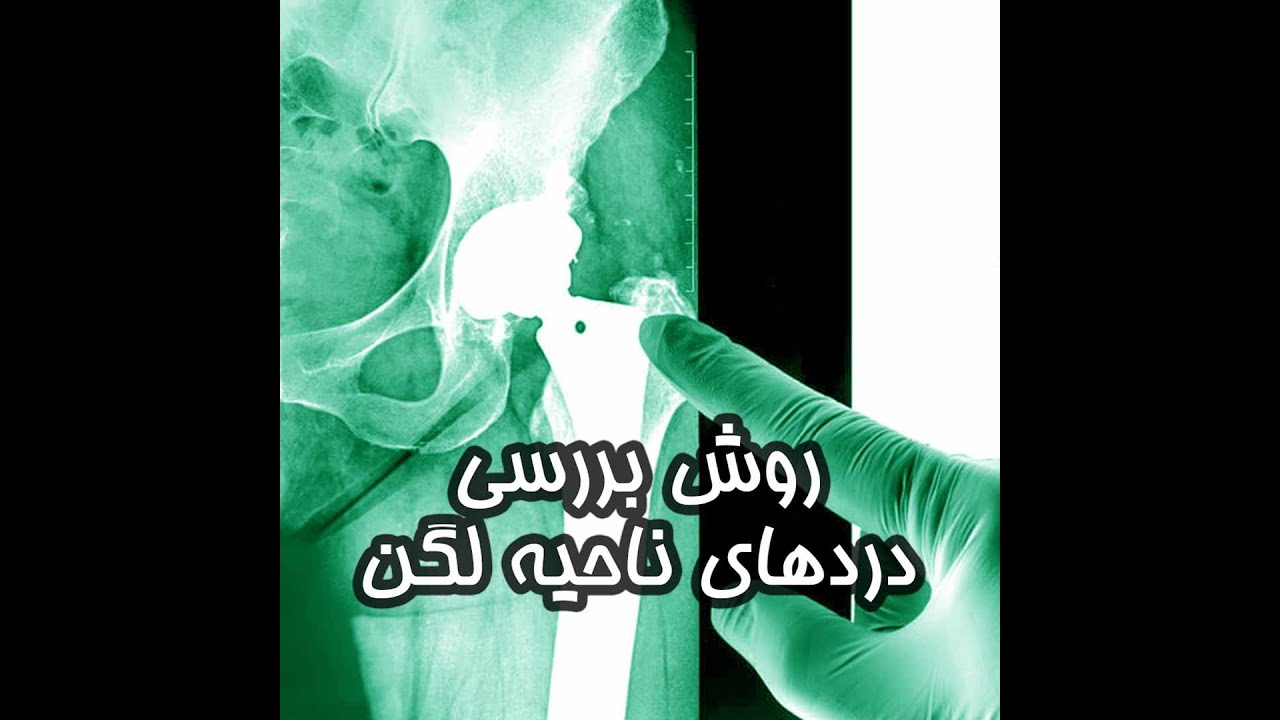 روش بررسی دردهای لگن