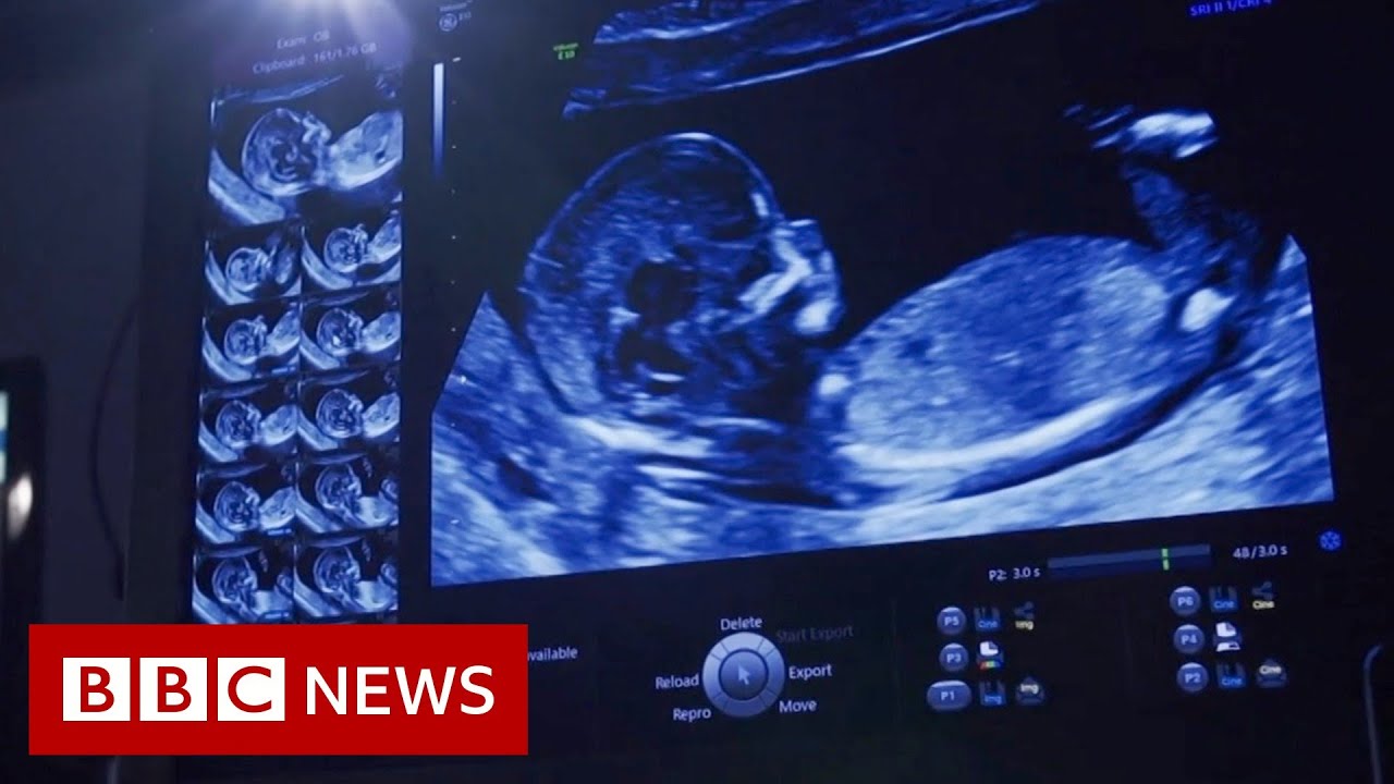 Private baby scan studios &lsquo;a growing concern&rsquo; - BBC News