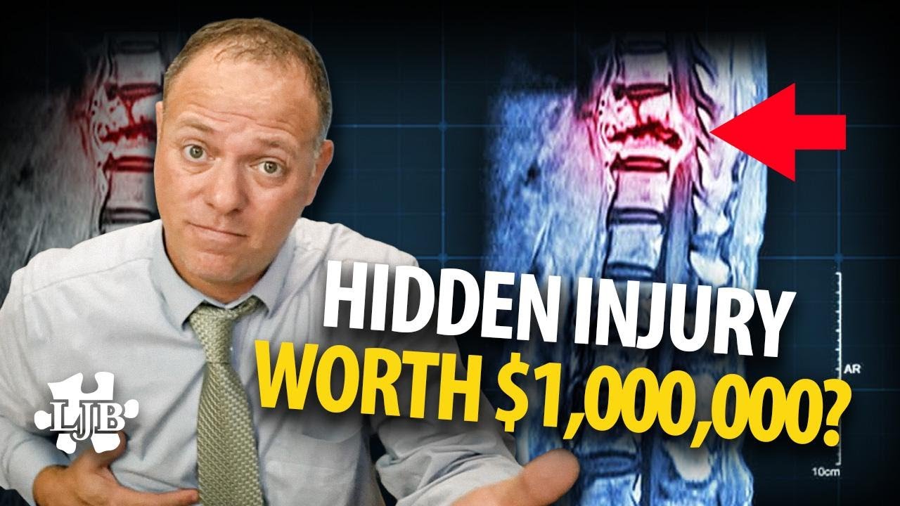 Delayed Symptoms After a Louisiana Car Crash, What You Need to Know