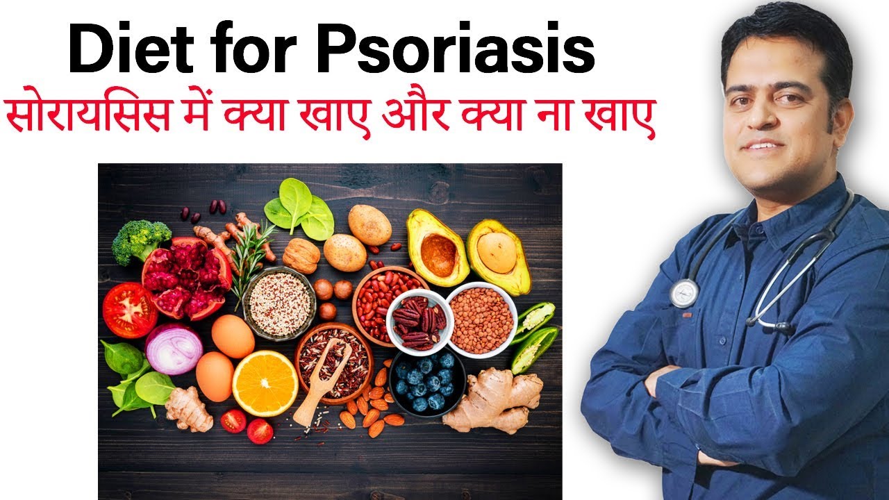 Diet in psoriasis | Food avoid in psoriasis | सोरायसिस में क्या नहीं खाये |