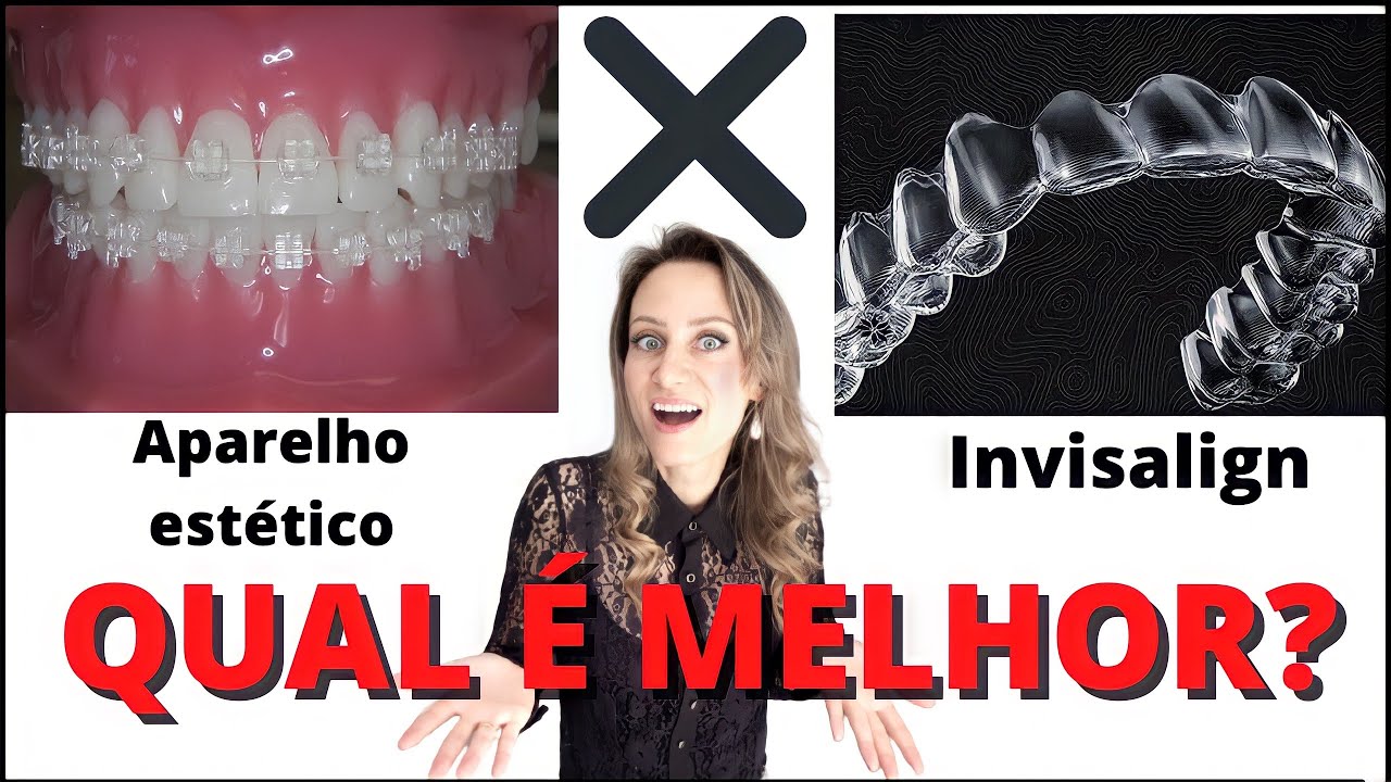 Qual a diferença entre aparelho estético e o alinhador invisalign?🧐 #aparelhoortodôntico #aparelho