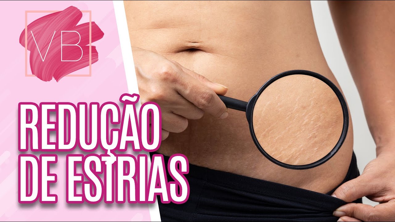 Momento Beleza: Protocolo de sucção a vácuo para reduzir as estrias - Você Bonita (25/05/2023)
