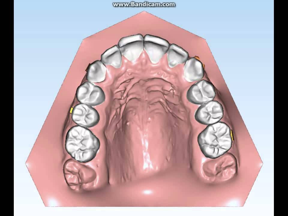 Ortodonzia Invisibile Aurodental 24092015