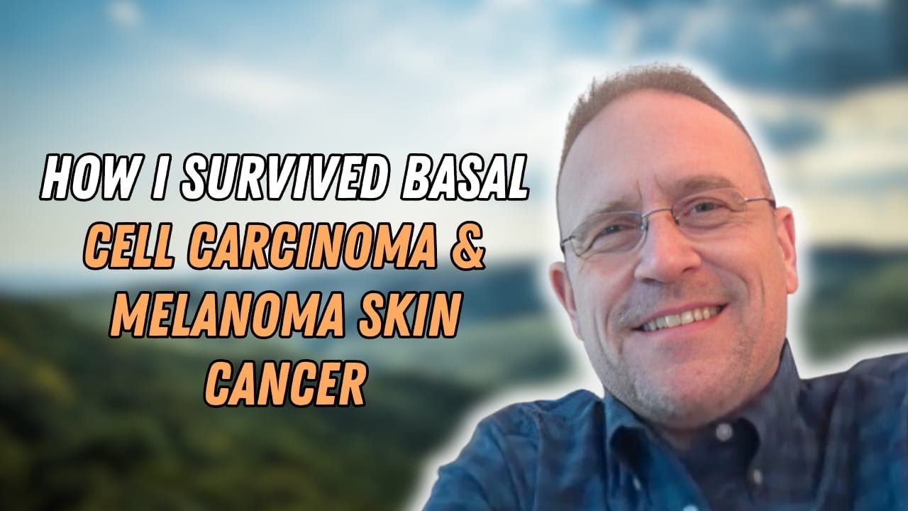 Chris Melton - Basal Cell Carcinoma Survivor - Fairfax Station, Virginia