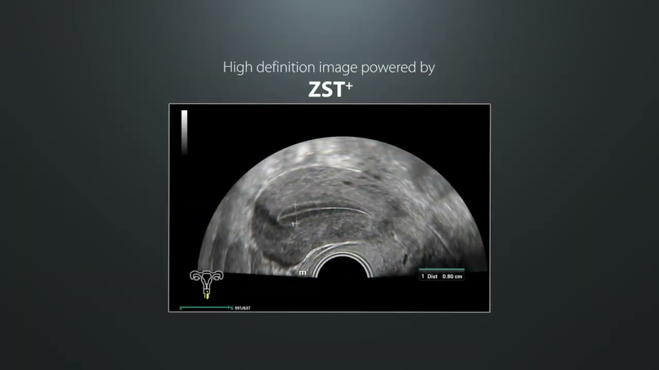 Mindray Resona I9
