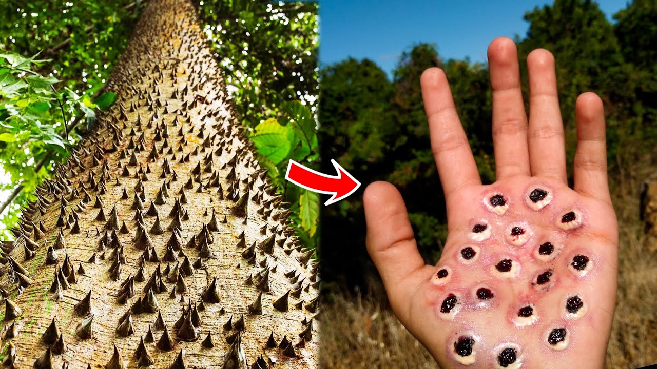 Most Dangerous Trees You Should NEVER Touch