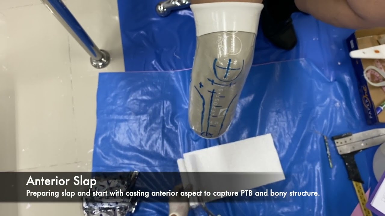TSB Measurement and Casting