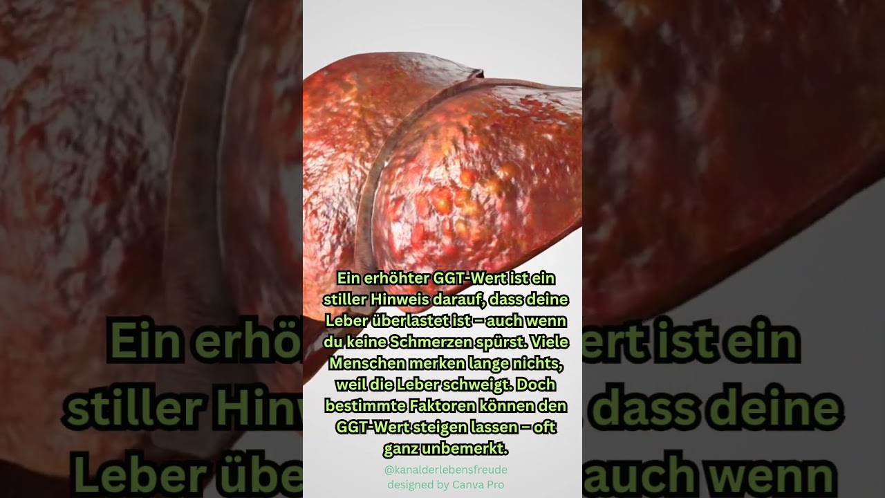 Was zeigt der Blutwert Gamma GT an? #gammagt #gesundheit