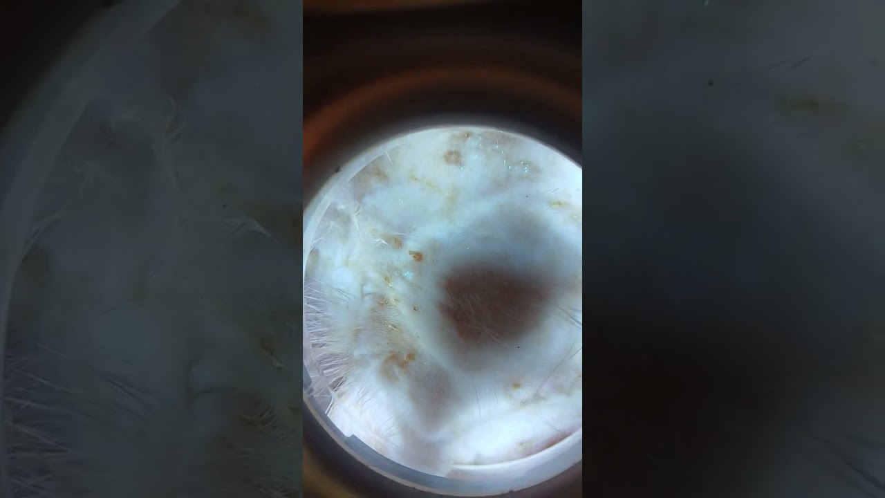 How to Use Wooden Lamp For Checking Fungal Infection 