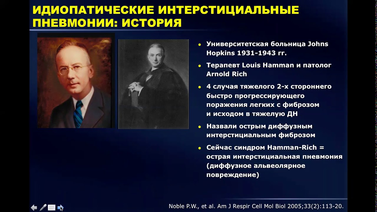 Интерстициальные болезни легких