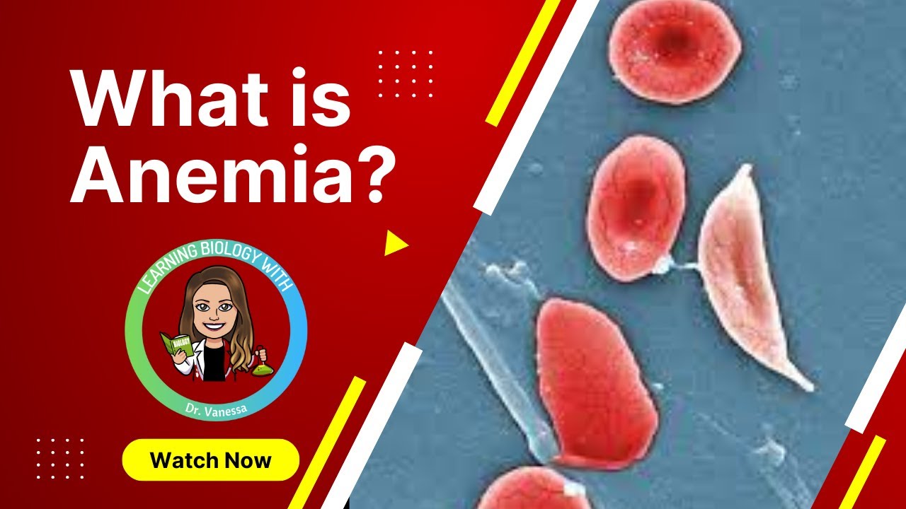 What is anemia? Types of Anemia | Circulatory System
