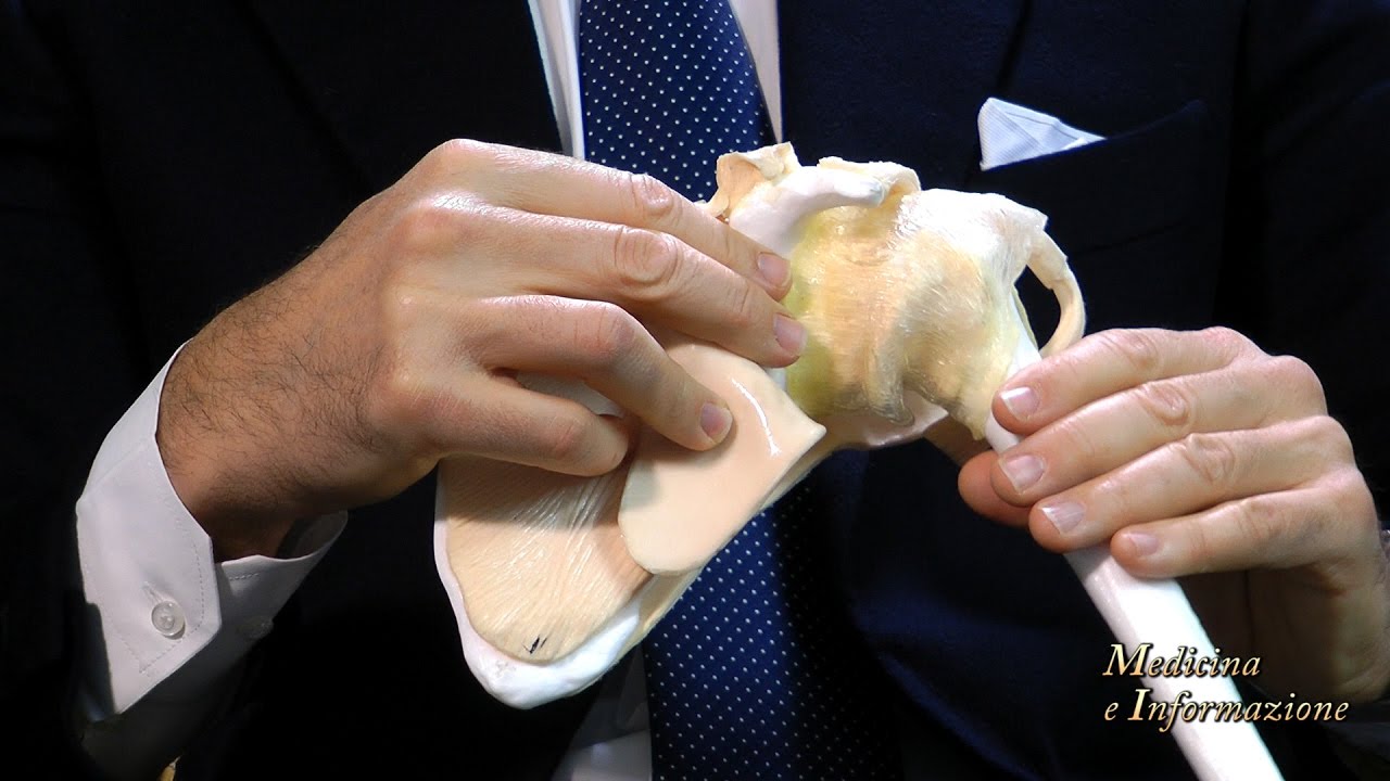 Chirurgia Protesica della Spalla: nuovi materiali e nuove tecniche (protesi inversa)
