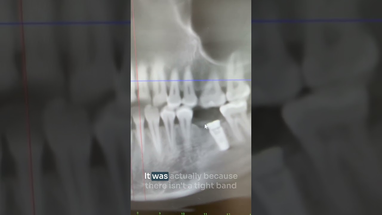 If you don't find a good dentist...this could happen. #shorts