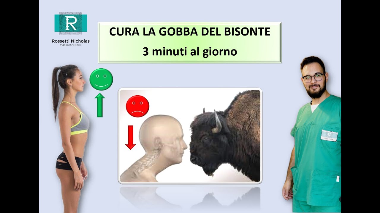CURA LA GOBBA DEL BISONTE! 3 minuti al giorno