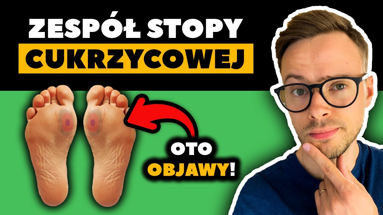 Powikłania cukrzycy: STOPA CUKRZYCOWA | Objawy, które muszą znać osoby z cukrzycą | Nie słodzę
