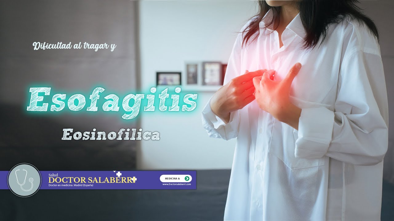 ESOFAGITIS EOSINOFÍLICA y dificultad al tragar
