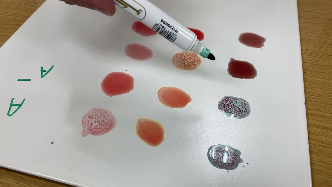 فحص الفصائل الدموية Blood grup test