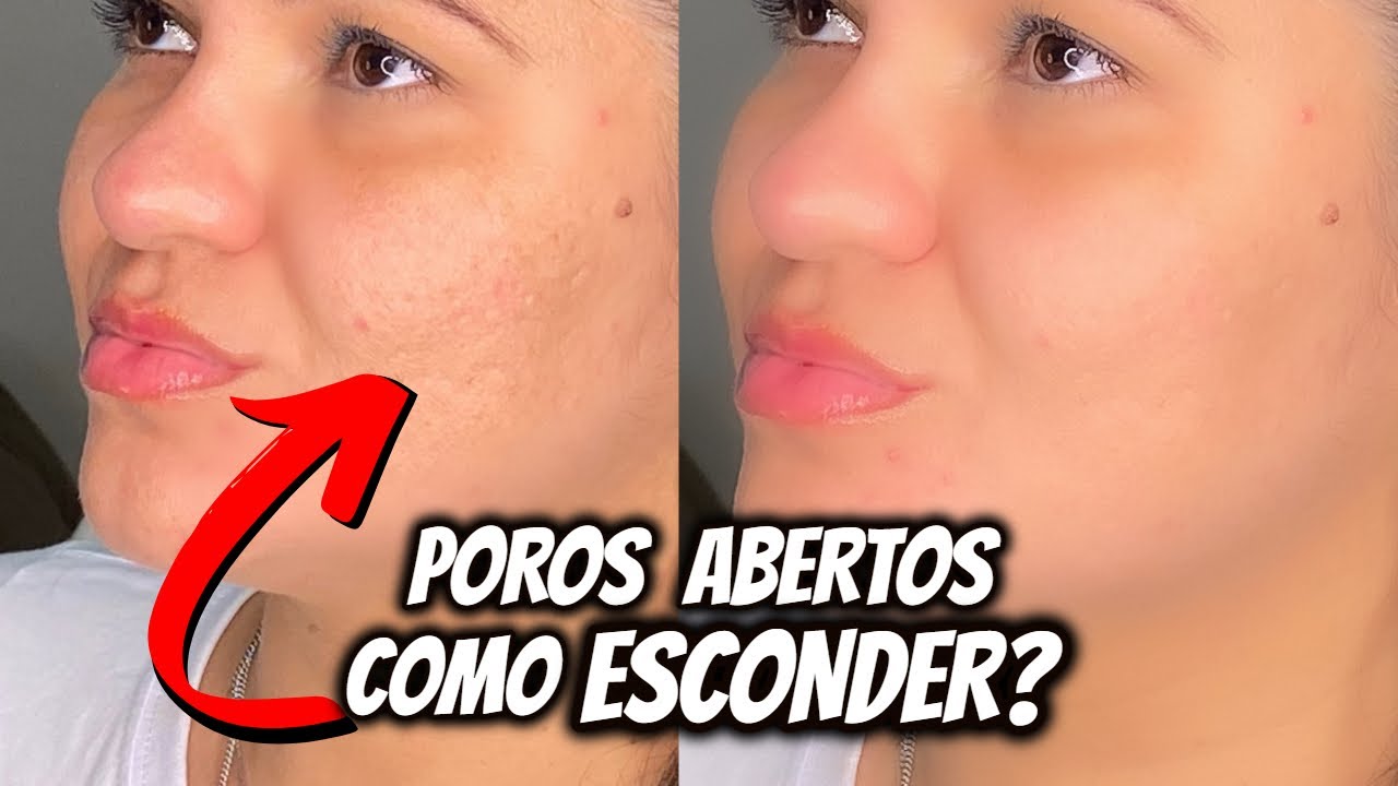 COMO AMENIZAR OS POROS DO ROSTO COM MAQUIAGEM | COMO AMENIZAR AS MARCAS DE ACNE COM MAQUIAGEM