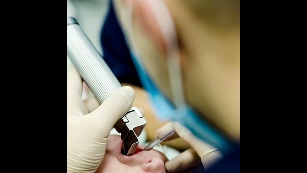 Prepare-se para intubação por sequência rápida
