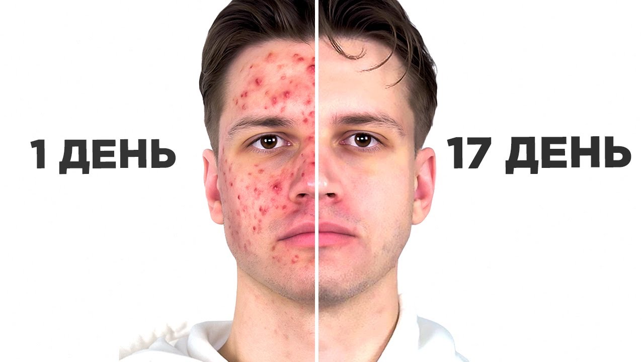 Я ухаживал за лицом 30 Дней подряд и вот что из этого вышло