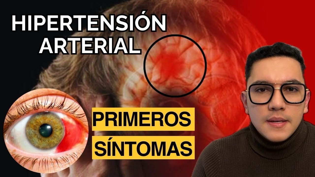 Primeros síntomas de hipertensión arterial | Dr. William Guerrero