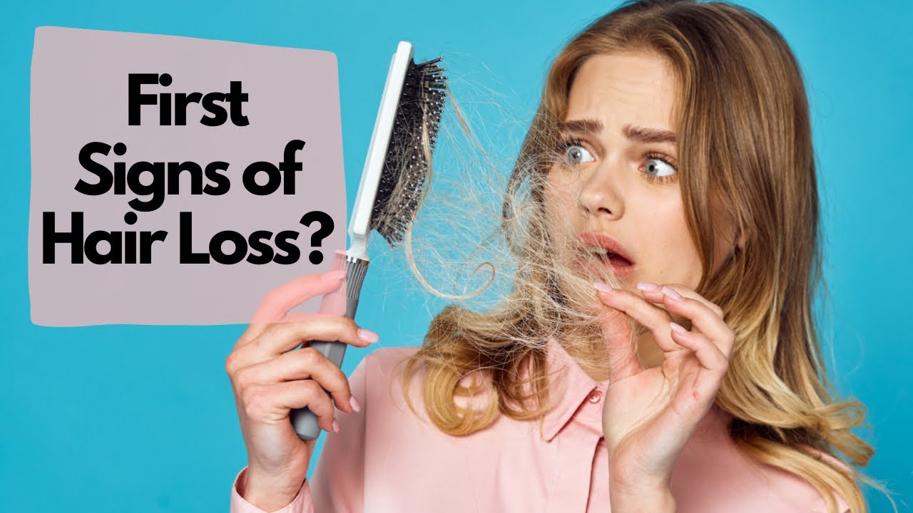 First Signs Of Hair Loss? 5 Things you NEED TO DO before even considering a hair transplant