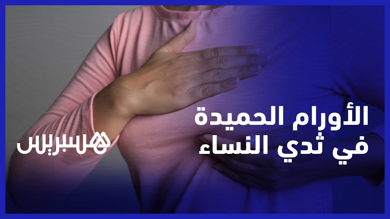 أورام الثدي الحميدة.. تعرفوا على أنواعها وعلاقتها مع الهرمونات من خلال الفيديو