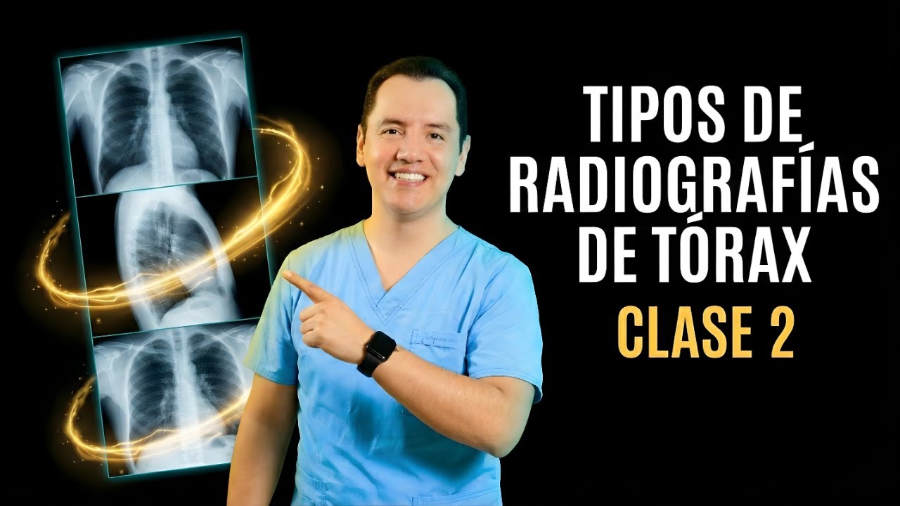 RADIOGRAFÍA de TÓRAX 🩻 | PROYECCIONES ESPECIALES 🎯: cuándo pedirlas | Curso para Estudiantes 🎓