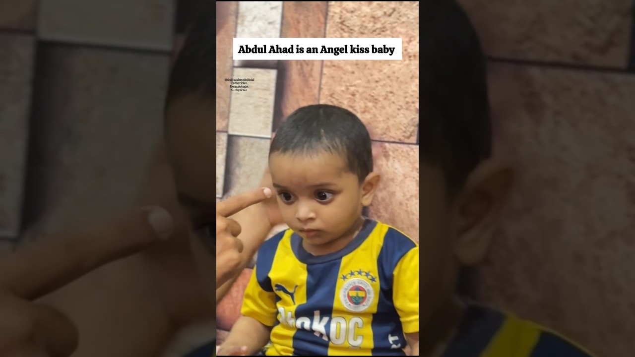 Agar Aapka Bacha Bhi Angel Kiss👼 Baby Hai To yeh Video Aapk Liye Hai  #baby #pediatrics #shortsfeed