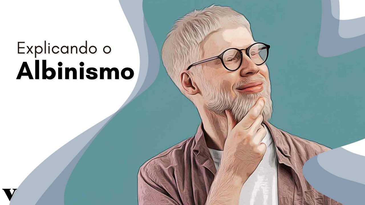 Entenda o Que É o Albinismo e Suas Complicações